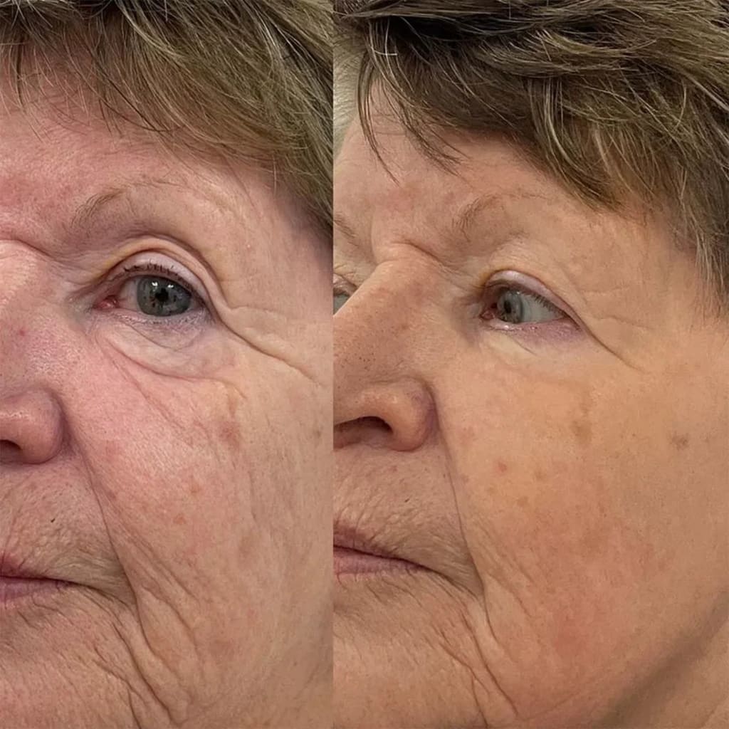 NAD+ Advanced Growth Factor Serum™