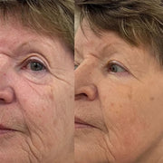 NAD+ Advanced Growth Factor Serum™