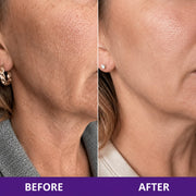 Collagen Retinol