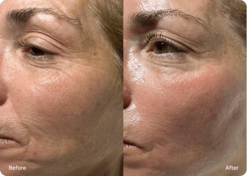 NAD+ Advanced Growth Factor Serum™