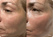 NAD+ Advanced Growth Factor Serum™