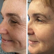 NAD+ Advanced Growth Factor Serum™