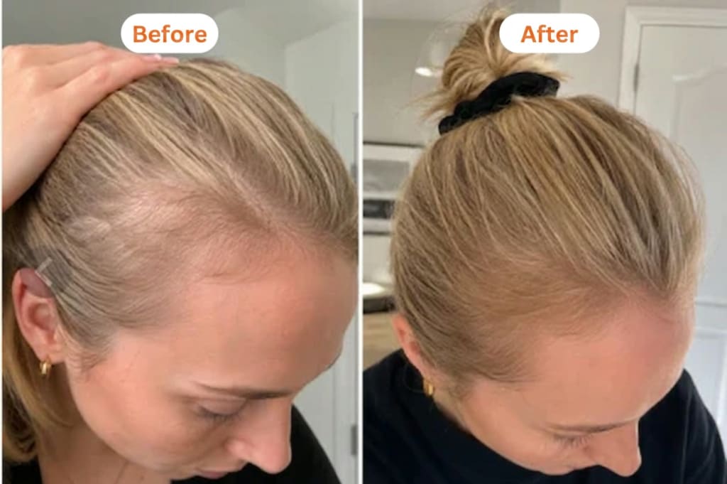 evonuvo PDRN™ Serum